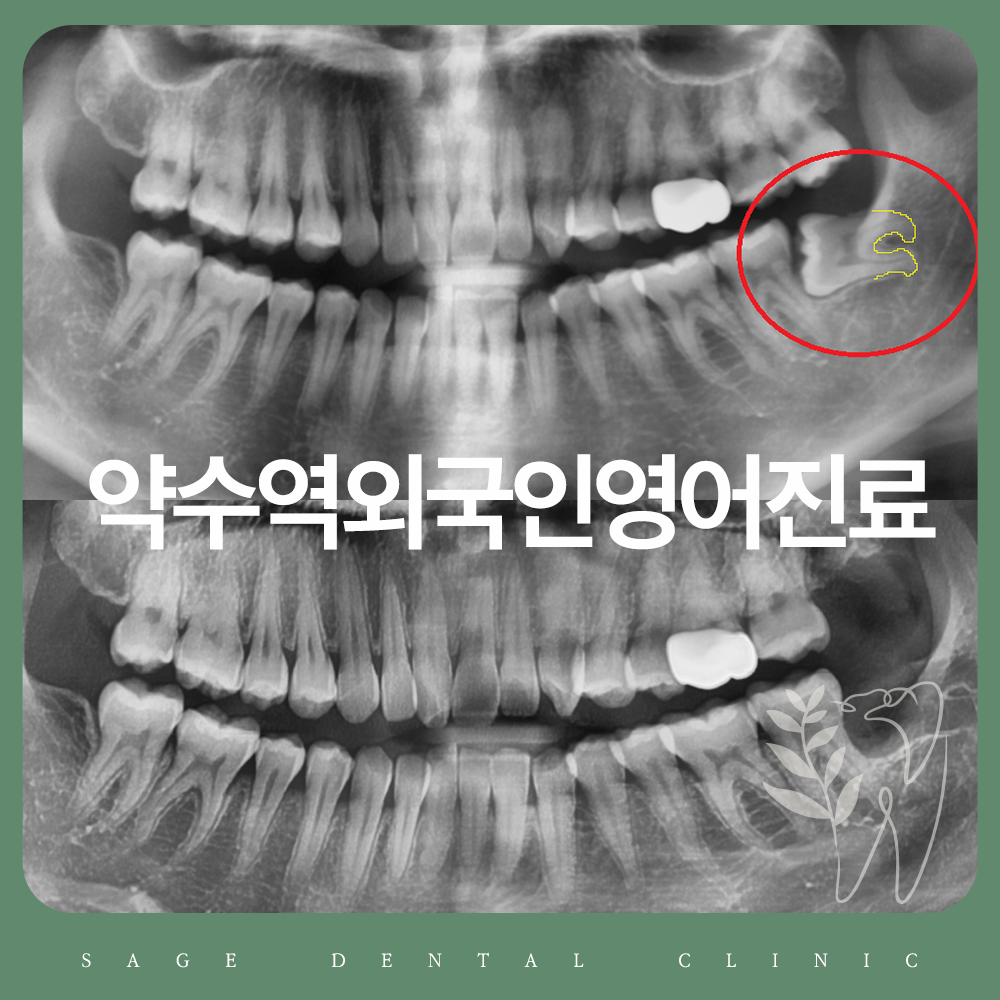 약수역외국인영어진료