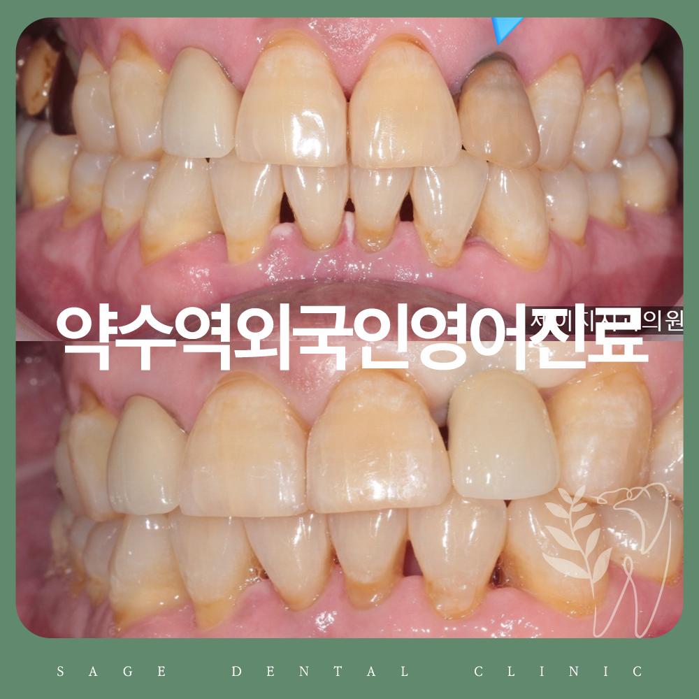 약수역외국인영어진료