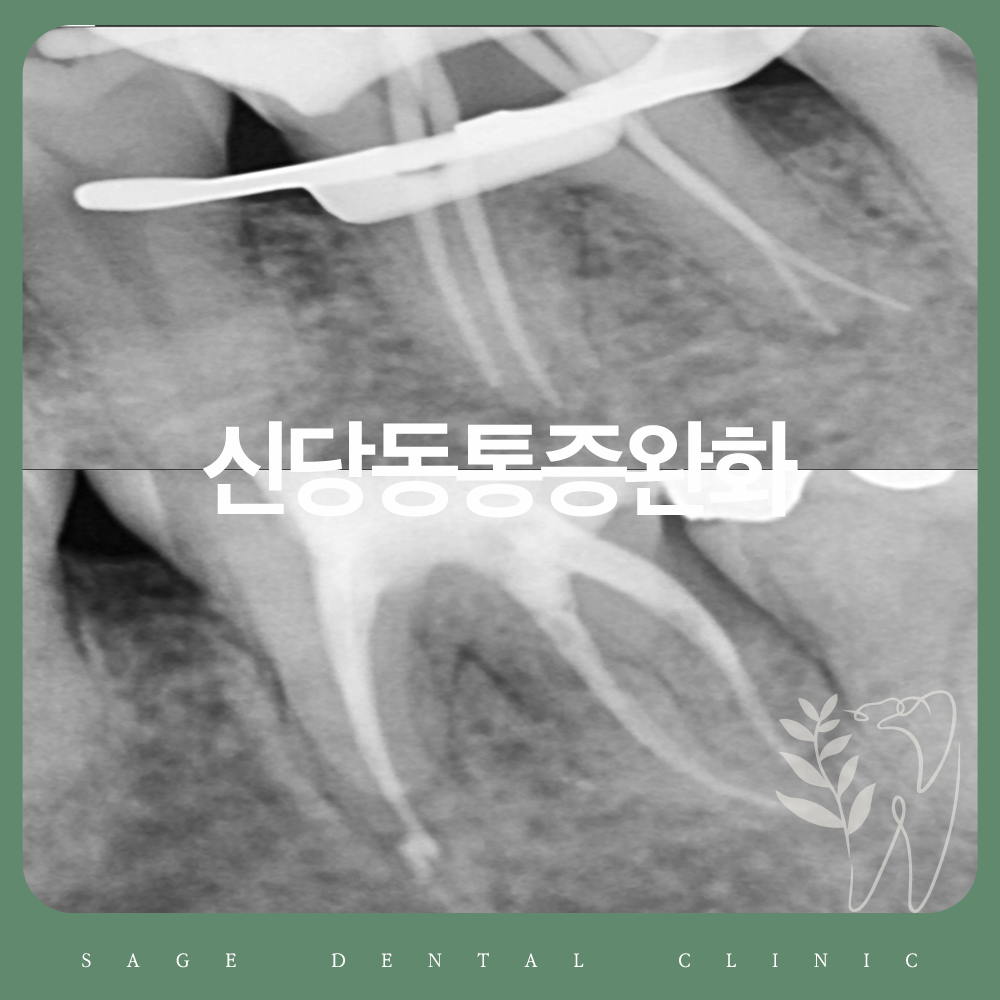 신당동통증완화