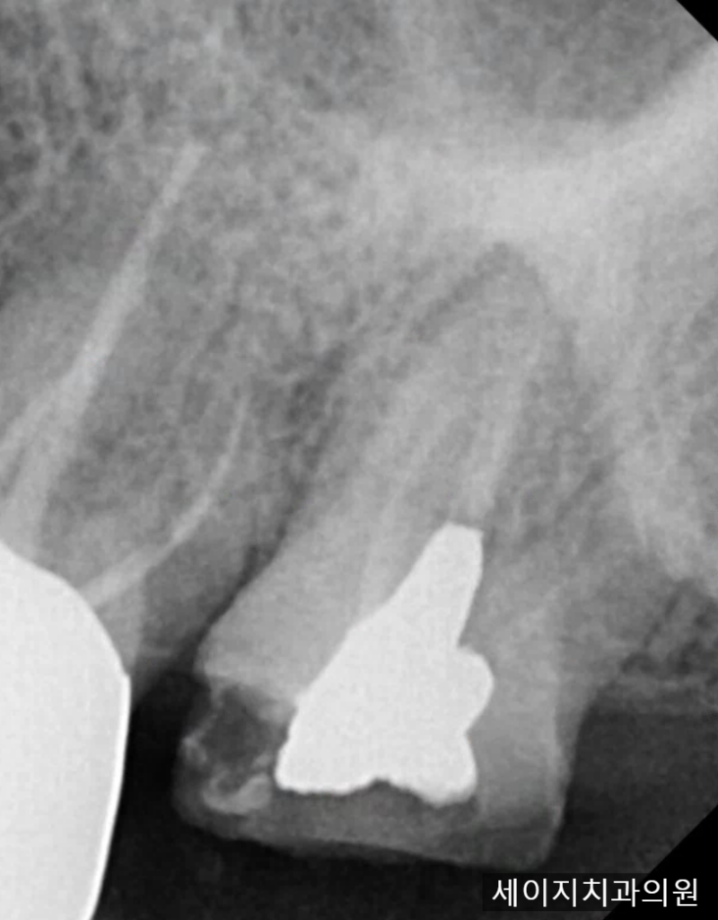 약수동통증완화