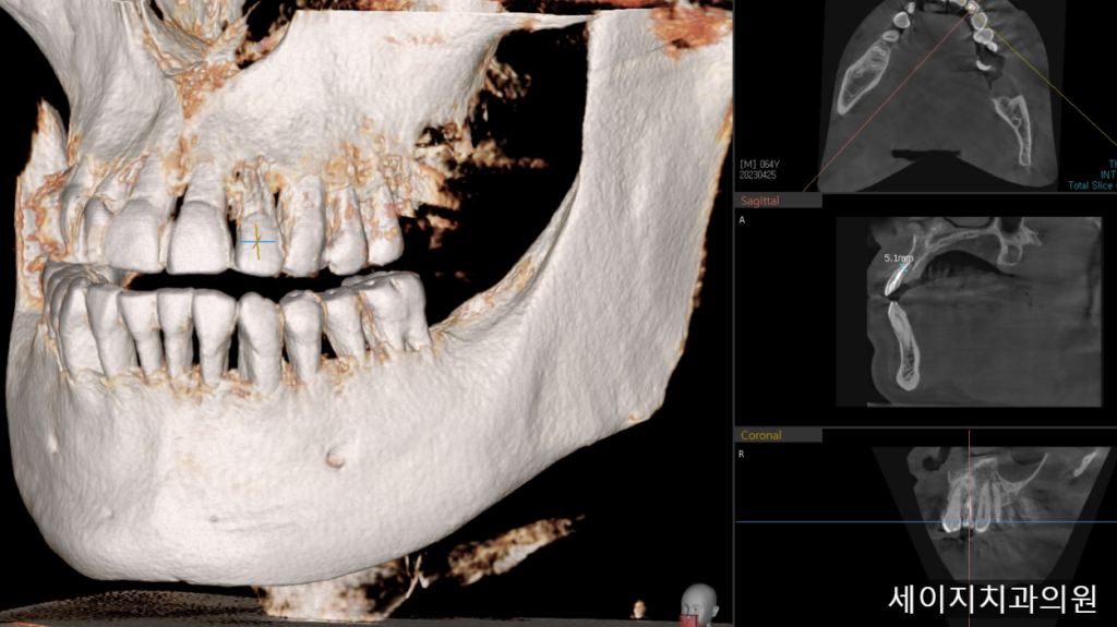 약수역외국인영어진료