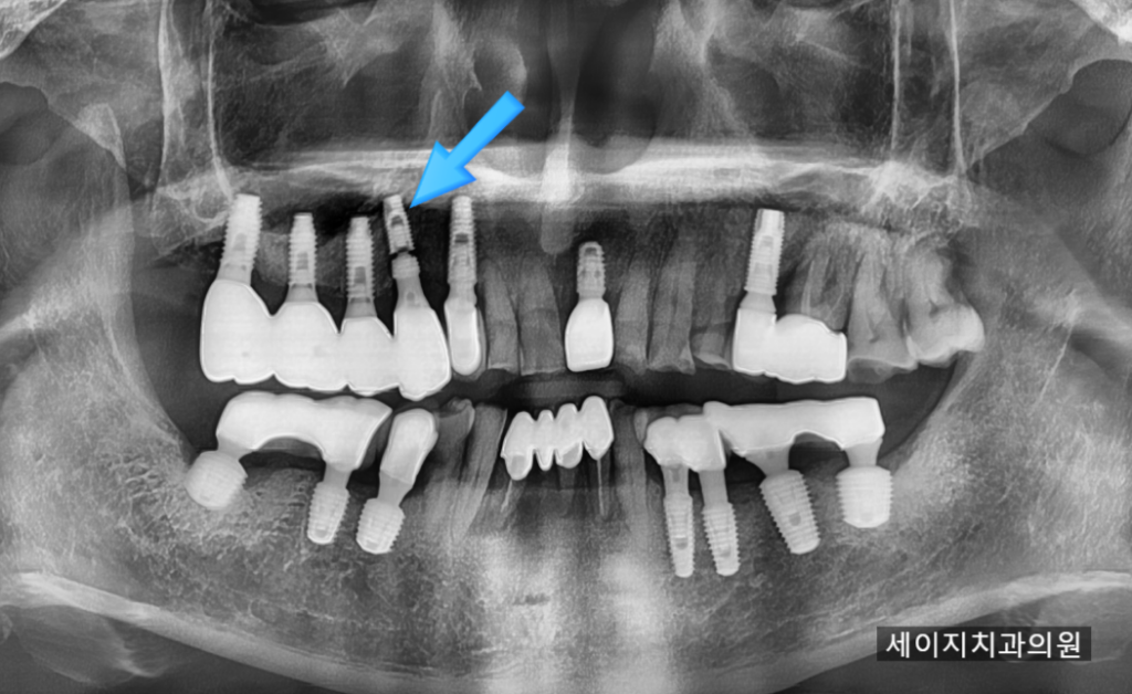 신당동외국인영어진료
