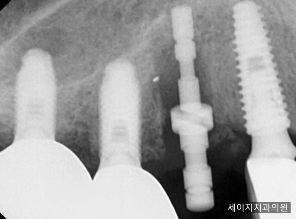 신당동외국인영어진료