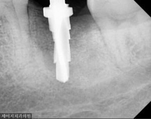 신당동외국인영어진료