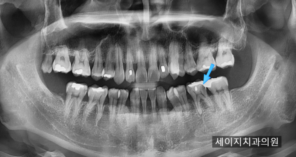 신당동통증완화