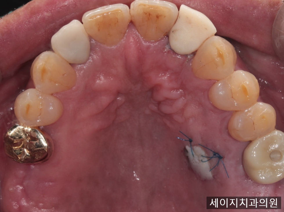 약수역외국인영어진료