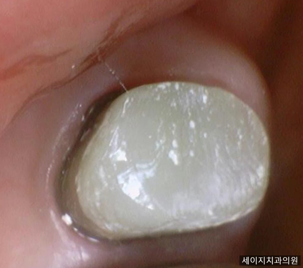 약수동통증완화