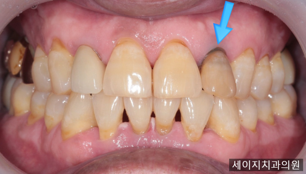 약수역외국인영어진료