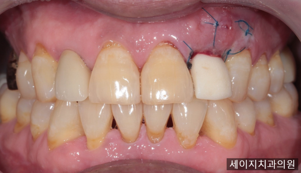 약수역외국인영어진료