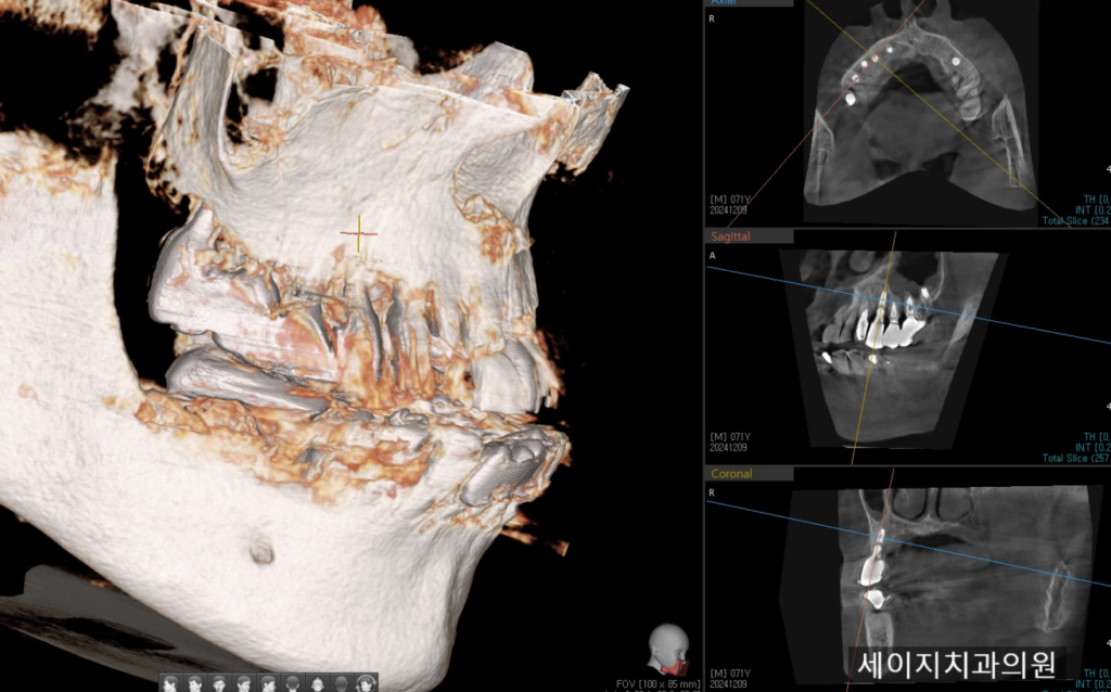 신당동외국인영어진료