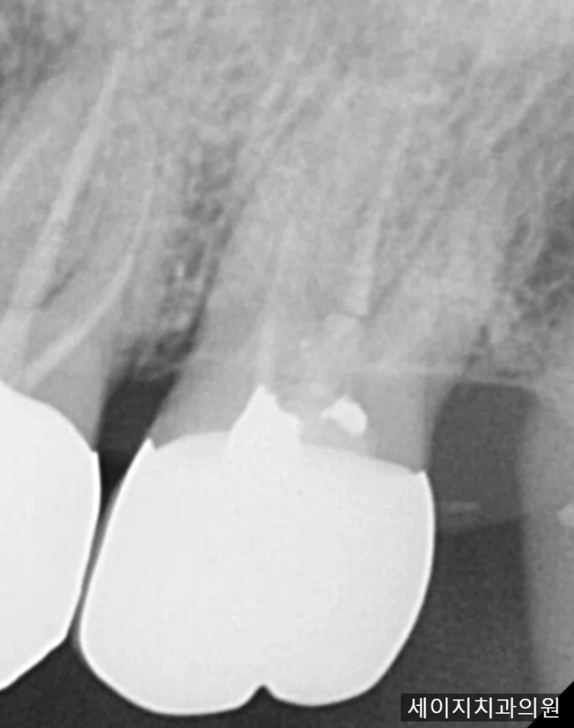 약수동통증완화