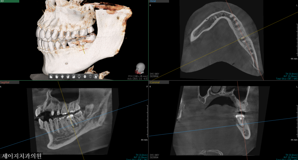 신당동외국인영어진료