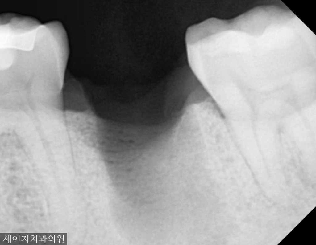 신당동외국인영어진료