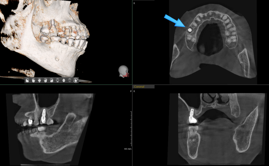 약수역통증완화