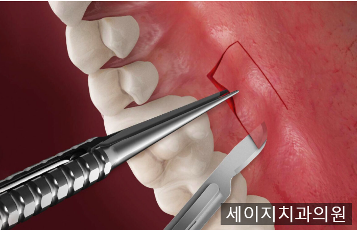 약수역외국인영어진료