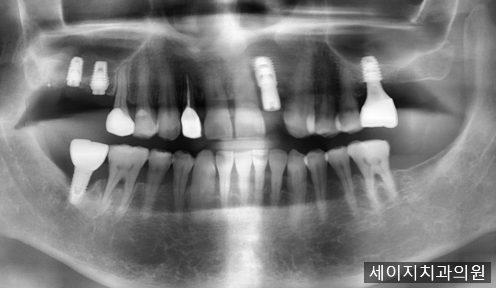 약수역외국인영어진료
