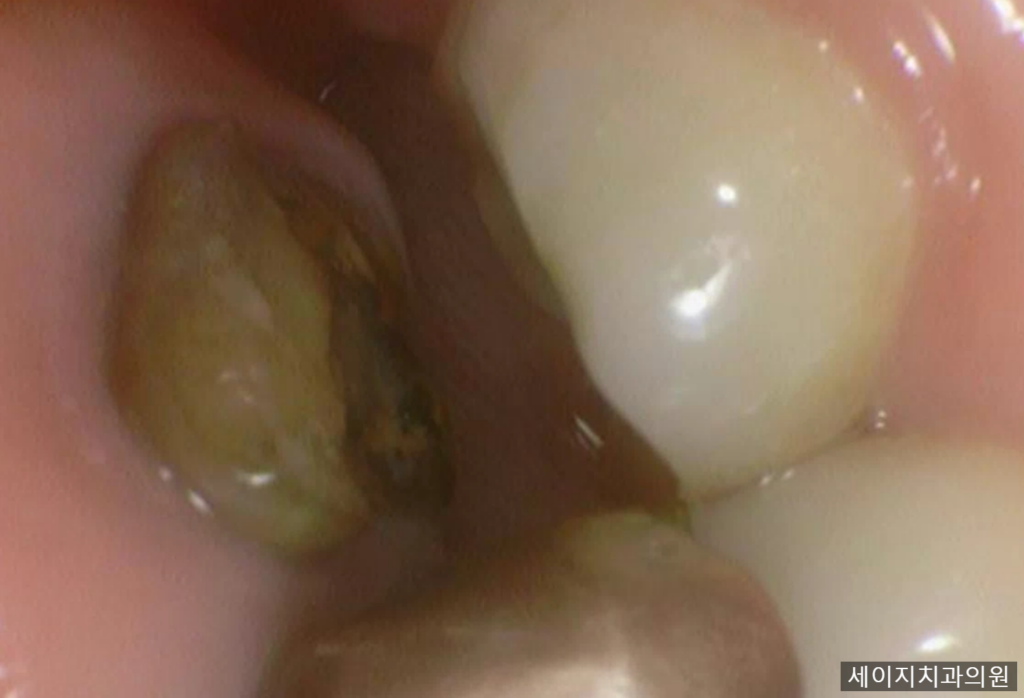 약수동통증완화