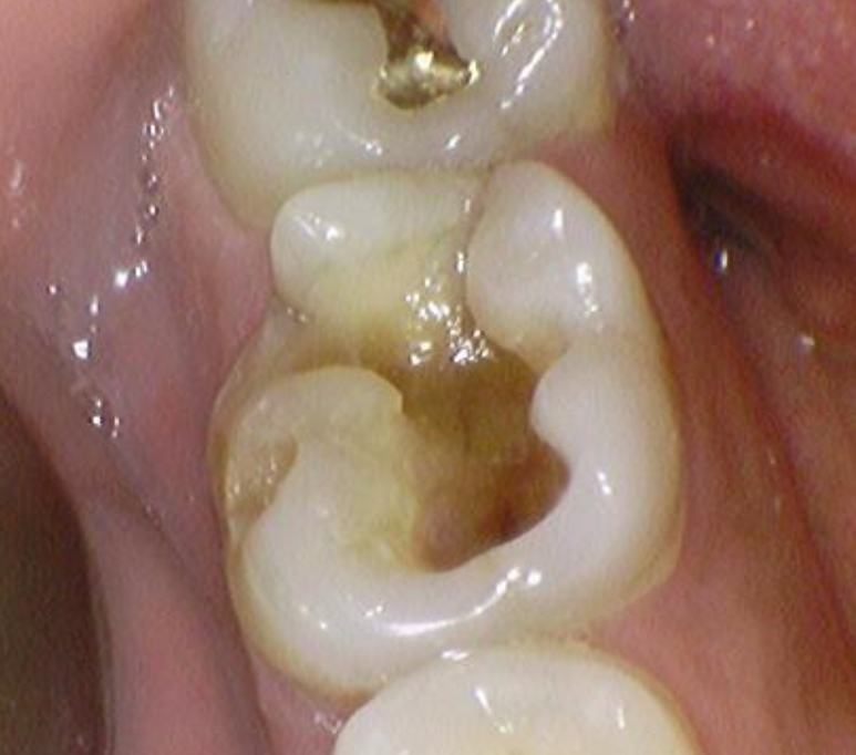 신당동통증완화