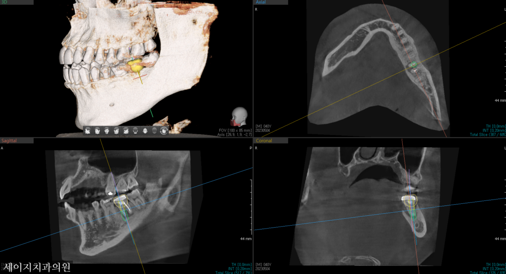 신당동외국인영어진료