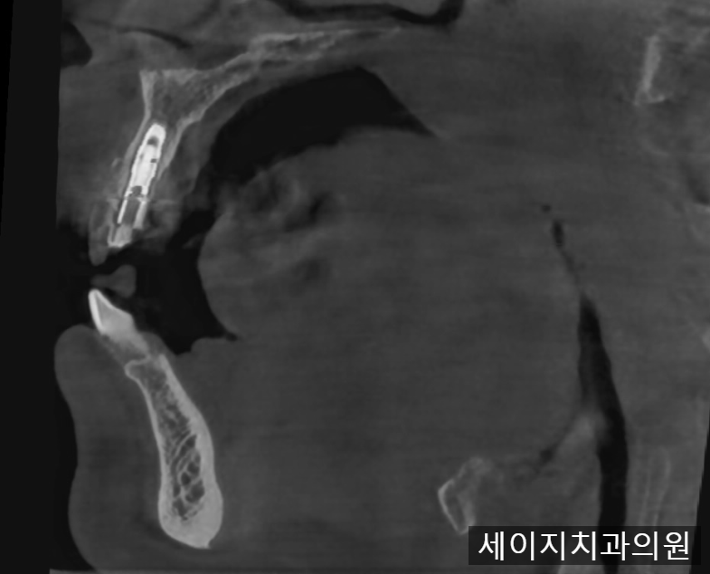 약수역외국인영어진료