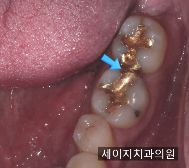신당동통증완화