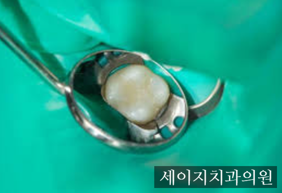 약수역앞니레진