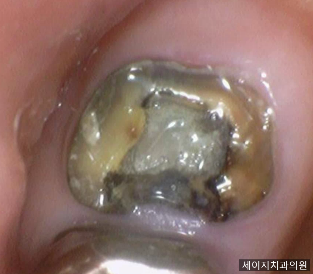 약수동통증완화