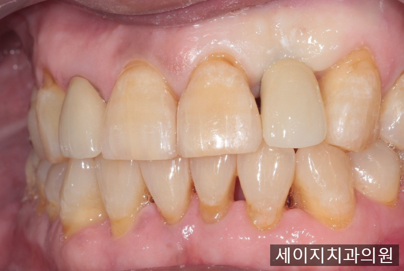 약수역외국인영어진료