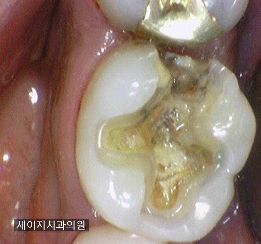 신당동통증완화