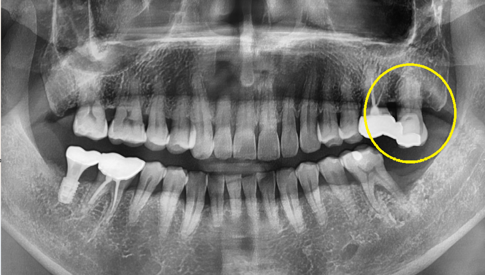 신당동통증완화