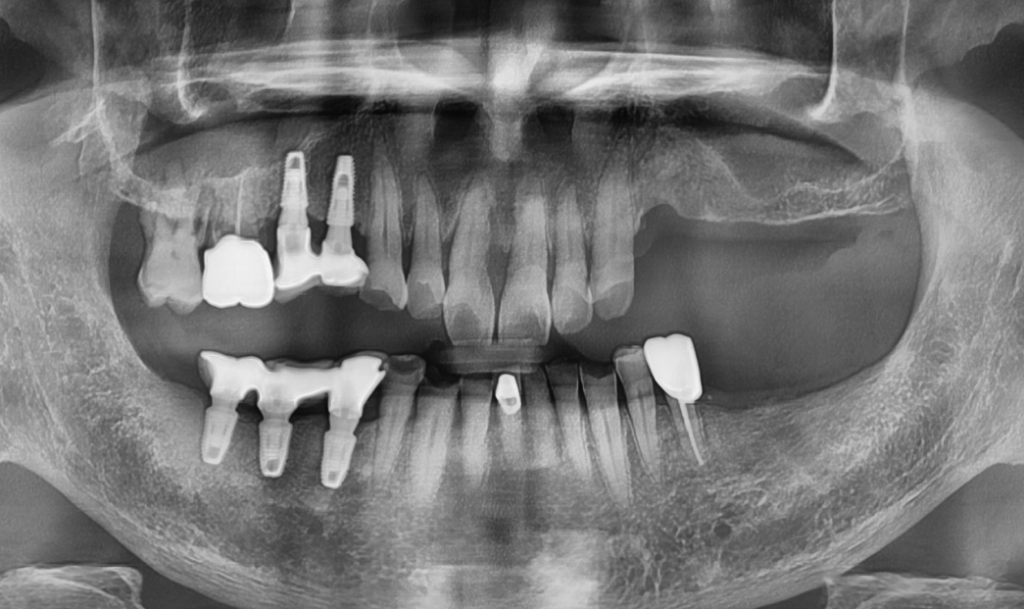 신당동통증완화