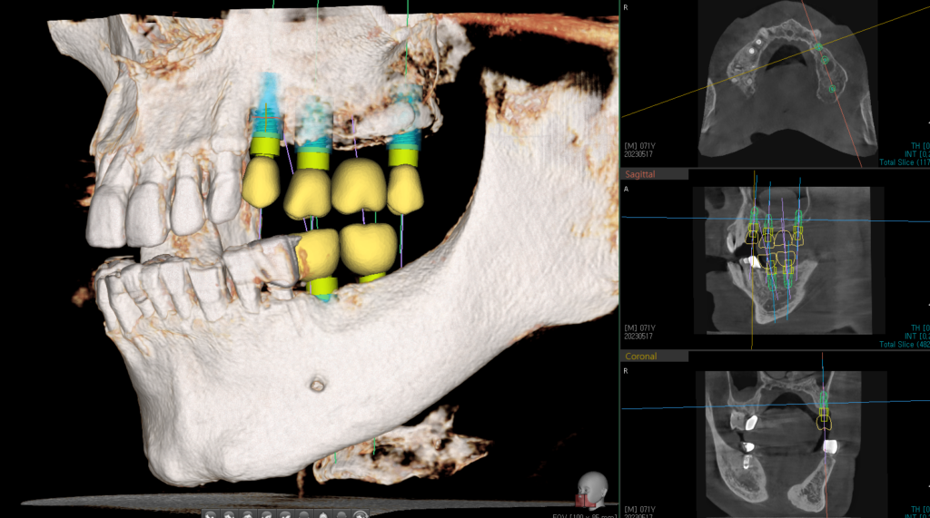신당동통증완화