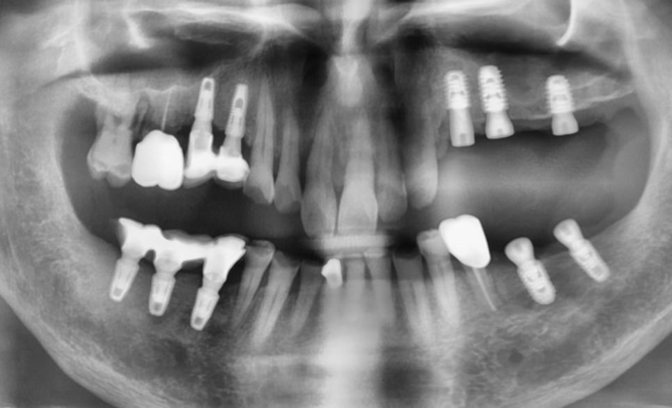 신당동통증완화