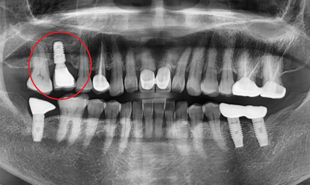 약수역통증완화