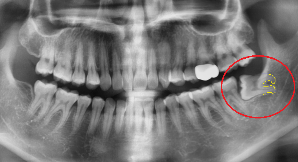 약수역외국인영어진료