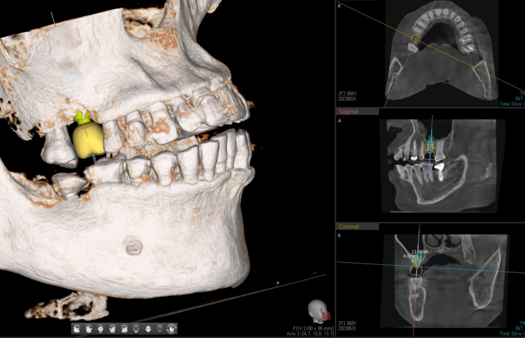 약수역통증완화