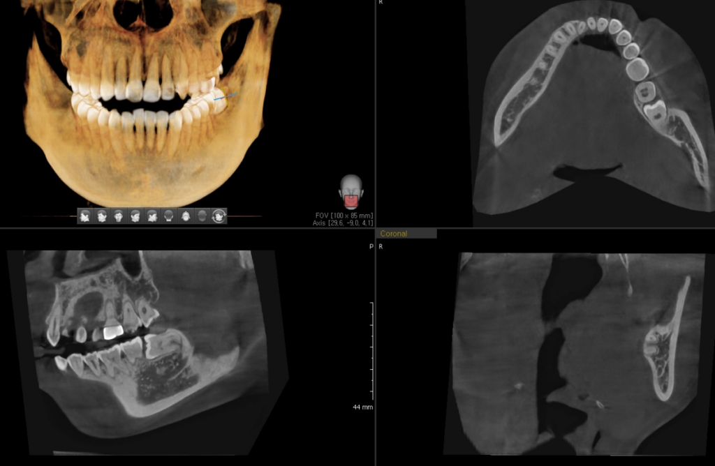 약수역외국인영어진료
