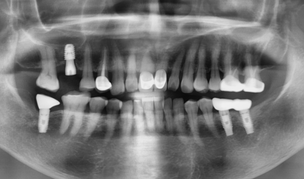 약수역통증완화