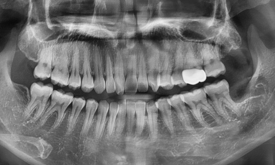 약수역외국인영어진료