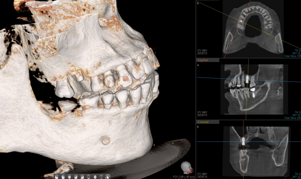 약수역통증완화