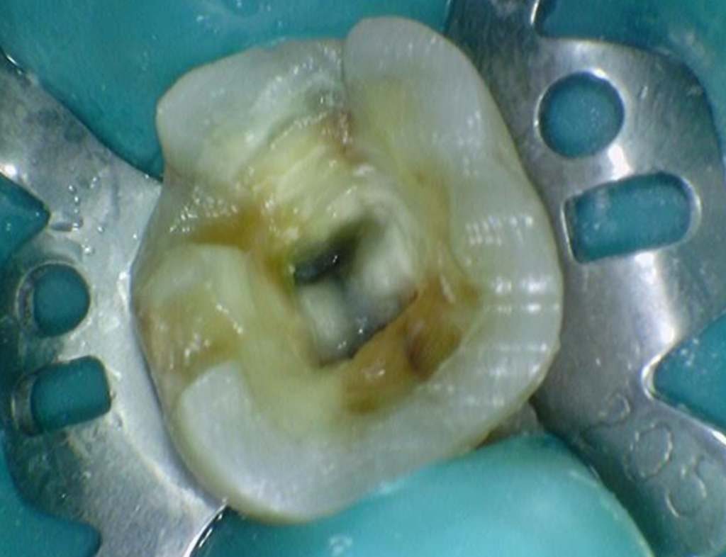 신당동통증완화