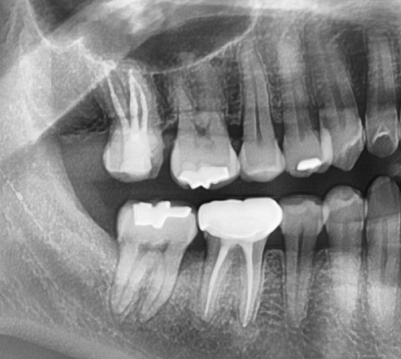 신당동통증완화