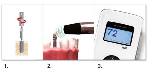 약수역통증완화