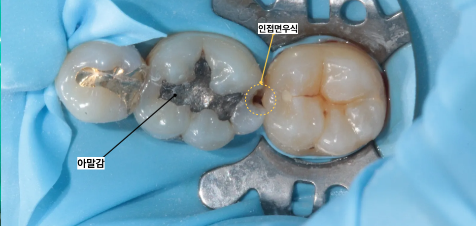 신당동통증완화