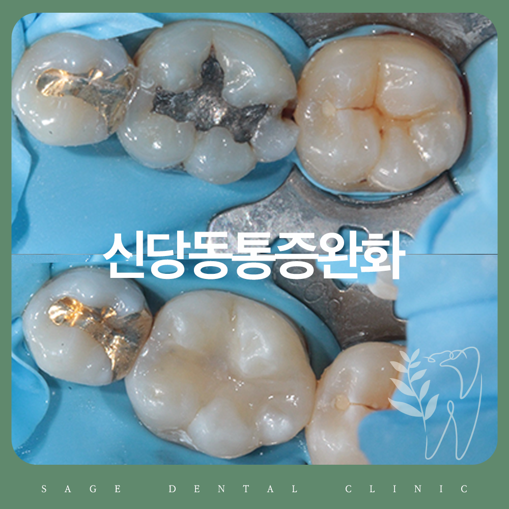 신당동통증완화