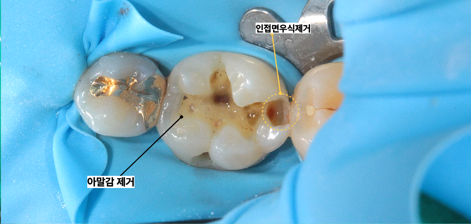 신당동통증완화