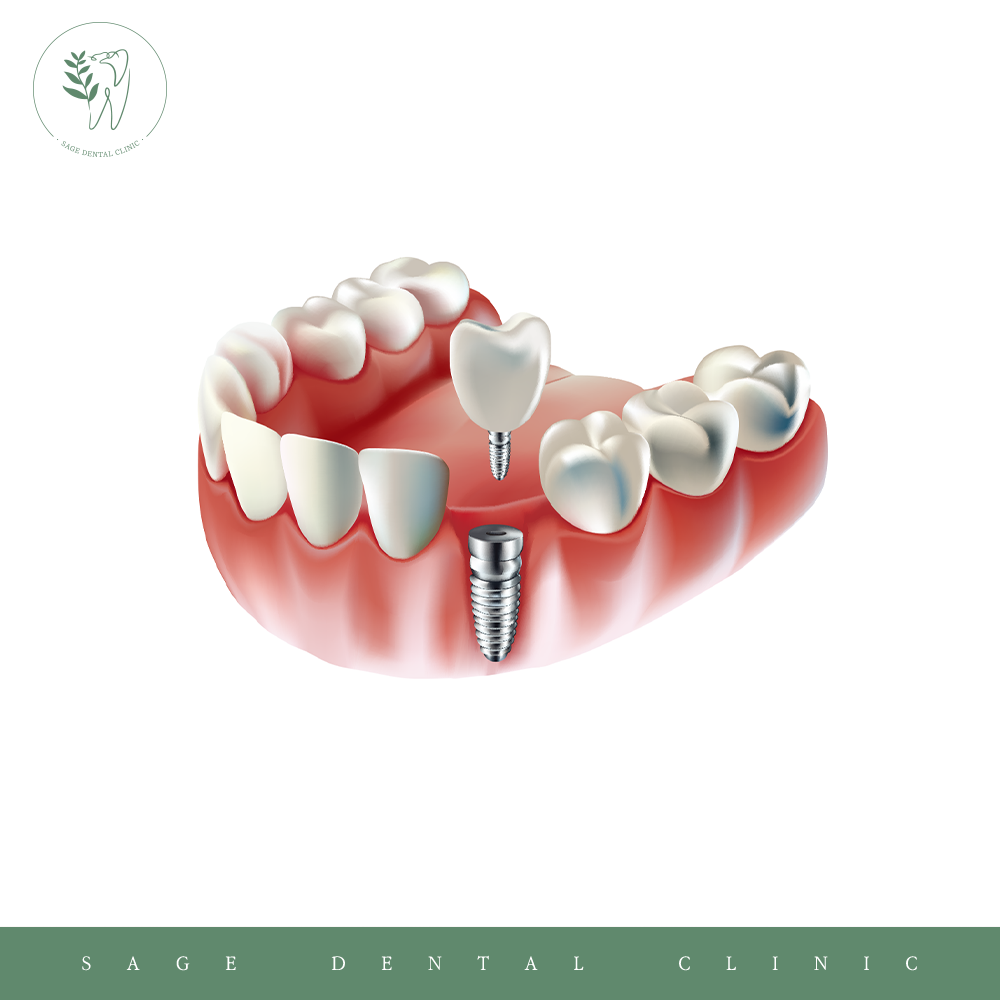 약수동통증완화