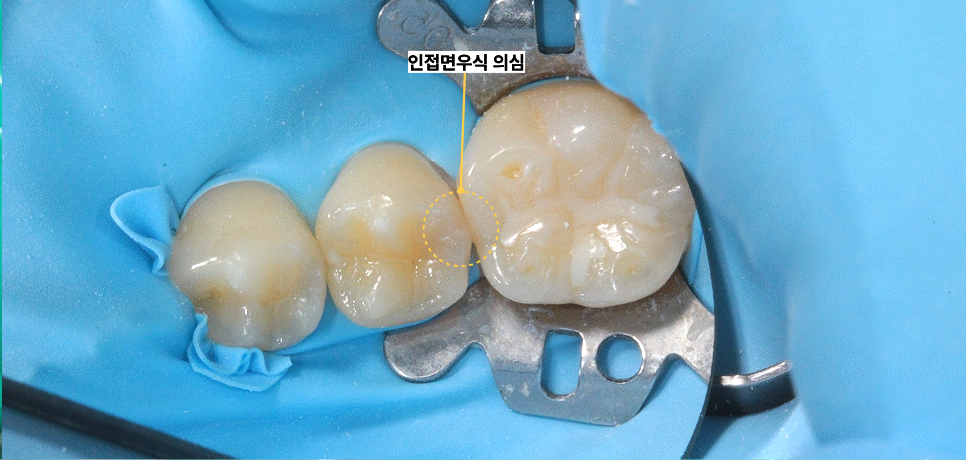 신당동통증완화