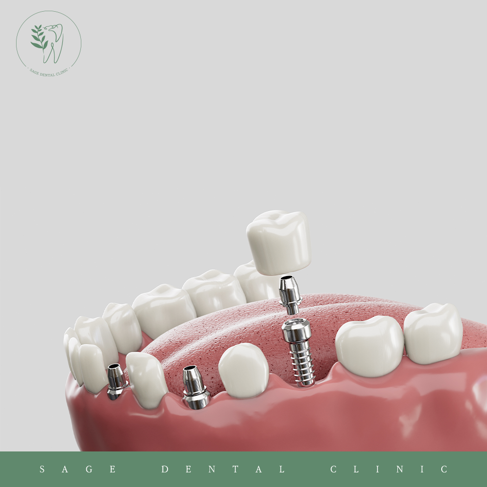 약수동통증완화