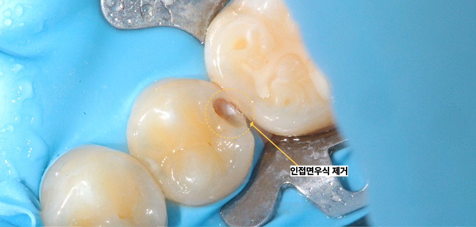 신당동통증완화